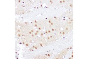 Immunohistochemistry of paraffin-embedded rat brain using SMOX Rabbit pAb (ABIN6132875, ABIN6148142, ABIN6148143 and ABIN6215369) at dilution of 1:100 (40x lens). (SMOX Antikörper  (AA 1-200))