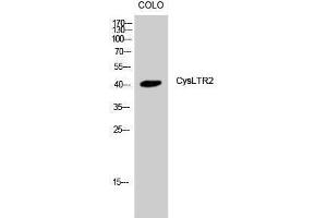 Western Blotting (WB) image for anti-Cysteinyl Leukotriene Receptor 2 (CYSLTR2) (C-Term) antibody (ABIN3184210) (CasLTR2 Antikörper  (C-Term))