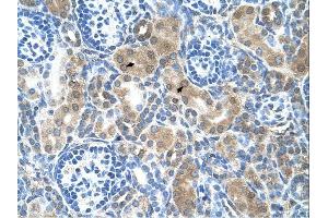 CBS antibody was used for immunohistochemistry at a concentration of 4-8 ug/ml. (CBS Antikörper  (N-Term))