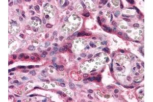 Immunohistochemical analysis of paraffin-embedded human Placenta tissues using CTNNB1 antibody (CTNNB1 Antikörper)