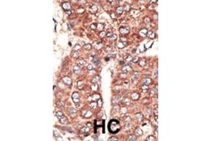 Immunohistochemistry (Paraffin-embedded Sections) (IHC (p)) image for anti-Low Density Lipoprotein Receptor-Related Protein 2 (LRP2) (AA 4626-4655), (C-Term) antibody (ABIN1537368)