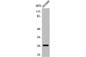 Western Blot analysis of Jurkat cells using PRSS33 Polyclonal Antibody (PRSS33 Antikörper  (Internal Region))