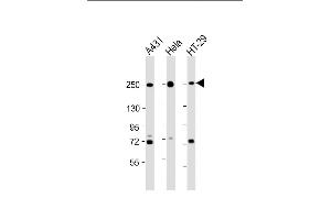 All lanes : Anti-MYH9 Antibody (C-term) at 1:2000 dilution Lane 1: A431 whole cell lysate Lane 2: Hela whole cell lysate Lane 3: HT-29 whole cell lysate Lysates/proteins at 20 μg per lane.