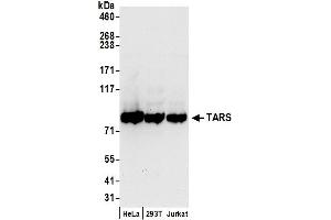 anti-threonyl-tRNA Synthetase (TARS) (AA 1-50) antibody
