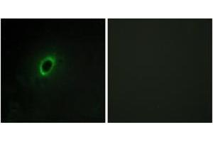 Immunofluorescence (IF) image for anti-Brain-Enriched Guanylate Kinase-Associated (BEGAIN) (AA 511-560) antibody (ABIN2889742) (BEGAIN Antikörper  (AA 511-560))