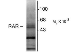 Western Blotting (WB) image for anti-Retinoic Acid Receptor, beta (RARB) (N-Term) antibody (ABIN371838) (Retinoic Acid Receptor beta Antikörper  (N-Term))
