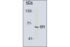Image no. 1 for anti-Estrogen Receptor 1 (ESR1) antibody (ABIN201714) (Estrogen Receptor alpha Antikörper)