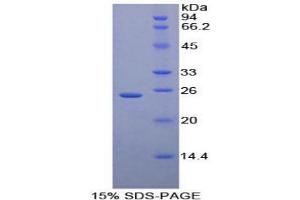 SDS-PAGE analysis of Human Iga Protein. (CD79a Protein)
