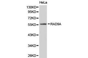 Western Blotting (WB) image for anti-RAD9 Homolog A (S. Pombe) (RAD9A) antibody (ABIN1874534) (RAD9A Antikörper)