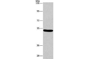 Western Blot analysis of Mouse brain tissue using ARC Polyclonal Antibody at dilution of 1:597 (ARC Antikörper)
