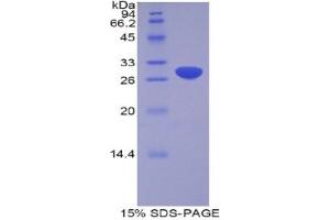 SDS-PAGE analysis of Human ADAM20 Protein. (ADAM20 Protein)