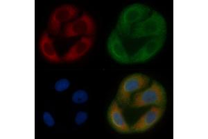 ALDH3B2 Mouse Monoclonal Antibody staining Hela cells by IF/ICC.