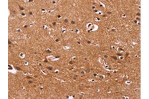 The image on the left is immunohistochemistry of paraffin-embedded Human brain tissue using ABIN7128511(ARL4A Antibody) at dilution 1/50, on the right is treated with fusion protein. (ARL4A Antikörper)