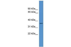 WB Suggested Anti-HNMT Antibody Titration: 0. (HNMT Antikörper  (N-Term))