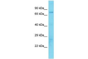 Host:  Rabbit  Target Name:  Foxk1  Sample Type:  Mouse Liver lysates  Antibody Dilution:  1. (Foxk1 Antikörper  (Middle Region))