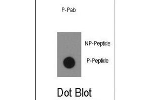 Dot Blot (DB) image for anti-C-Abl Oncogene 1, Non-Receptor tyrosine Kinase (ABL1) (pTyr134) antibody (ABIN3001743) (ABL1 Antikörper  (pTyr134))