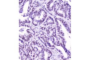 IHC analysis of SMC3 using anti-SMC3 antibody (ABIN5693037). (SMC3 Antikörper  (C-Term))