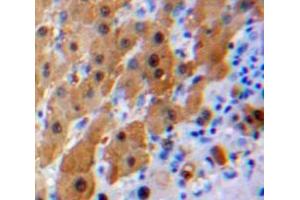 Used in DAB staining on fromalin fixed paraffin-embedded Liver tissue (IL16 Antikörper  (AA 1203-1322))