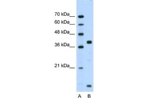 Western Blotting (WB) image for anti-FXYD Domain Containing Ion Transport Regulator 5 (FXYD5) antibody (ABIN2461114) (FXYD5 Antikörper)