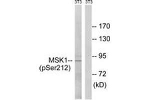 Western blot analysis of extracts from NIH-3T3 cells treated with EGF 200ng/ml 5', using MSK1 (Phospho-Ser212) Antibody.