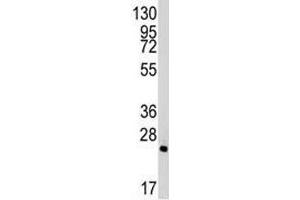 Western Blotting (WB) image for anti-BH3 Interacting Domain Death Agonist (BID) (AA 68-103) antibody (ABIN3028508)