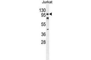 CWC22 Antibody (N-term) western blot analysis in Jurkat cell line lysates (35µg/lane). (CWC22 Antikörper  (N-Term))