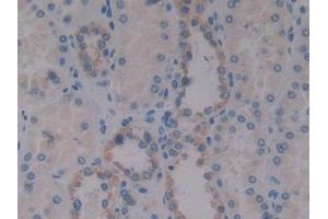 DAB staining on IHC-P; Samples: Human Kidney Tissue (Insulin Like Protein 3 (AA 2-129) Antikörper)