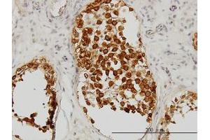 Image no. 1 for anti-Deleted in Azoospermia 1 (DAZ1) (AA 21-121) antibody (ABIN598640) (DAZ1 Antikörper  (AA 21-121))