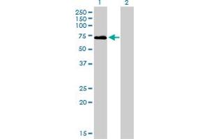 Western Blot analysis of F2 expression in transfected 293T cell line by F2 monoclonal antibody (M01), clone 1B7. (Prothrombin Antikörper  (AA 263-362))