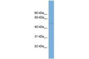 Image no. 1 for anti-Protein Phosphatase 2, Regulatory Subunit B', epsilon Isoform (PPP2R5E) (AA 35-84) antibody (ABIN6746458)