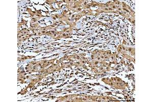 IHC analysis of NF1 using anti-NF1 antibody (ABIN7600195).