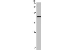 Gel: 8 % SDS-PAGE, Lysate: 40 μg, Lane: Mouse lung tissue, Primary antibody: ABIN7130211(MECP2 Antibody) at dilution 1/300, Secondary antibody: Goat anti rabbit IgG at 1/8000 dilution, Exposure time: 3 minutes (MECP2 Antikörper)