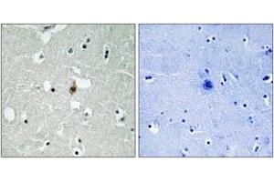 Immunohistochemistry analysis of paraffin-embedded human brain tissue, using E2A (Ab-355) Antibody. (TCF3 Antikörper  (AA 321-370))