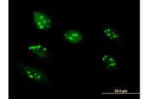 Immunofluorescence of purified MaxPab antibody to RRS1 on HeLa cell. (RRS1 Antikörper  (AA 1-365))