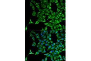 Immunofluorescence (IF) image for anti-Keratin 20 (KRT20) (AA 245-424) antibody (ABIN3020782)