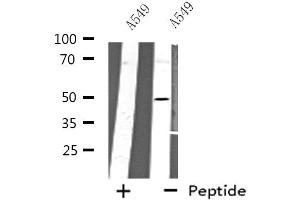 Western blot analysis of extracts from A549 cells using CHRNA10 antibody. (CHRNA10 Antikörper  (C-Term))