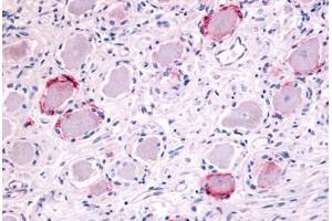 Anti-TRPA1 antibody  ABIN1049431 IHC staining of human ganglion cells.