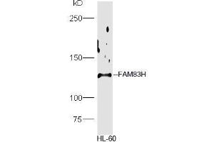 HL-60 lysate probed with Rabbit Anti-FAM83H Polyclonal Antibody, Unconjugated  at 1:5000 for 90min at 37˚C. (FAM83H Antikörper  (AA 1001-1179))