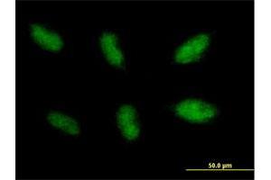Immunofluorescence of purified MaxPab antibody to NHEJ1 on HepG2 cell. (NHEJ1 Antikörper  (AA 1-299))