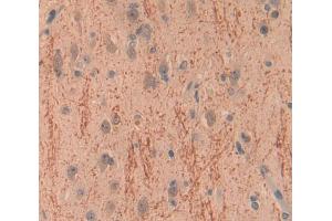 Used in DAB staining on fromalin fixed paraffin- embedded Kidney tissue (BCR Antikörper  (AA 1042-1243))