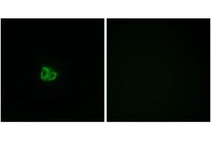 Immunofluorescence analysis of COS7 cells, using Stathmin 1 (Phospho-Ser15) Antibody. (Stathmin 1 Antikörper  (pSer16))