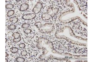 Image no. 1 for anti-TATA Box Binding Protein Associated Factor 11 (TAF11) (AA 158-211) antibody (ABIN598958) (TAF11 Antikörper  (AA 158-211))