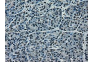 Immunohistochemistry (IHC) image for anti-CD4 (CD4) antibody (ABIN2718031)