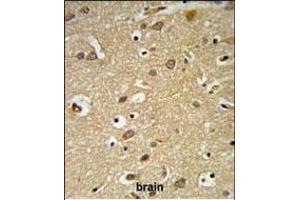 Immunohistochemistry (Paraffin-embedded Sections) (IHC (p)) image for anti-Insulin-Like Growth Factor 1 Receptor (IGF1R) (AA 51-77), (N-Term) antibody (ABIN652374)