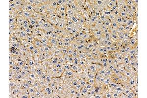 ABIN7096207 and ABIN7100269 at 1/100 staining mouse liver tissue by IHC-P. (SLFN5 Antikörper)