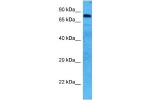 Host:  Mouse  Target Name:  HSP90AB1  Sample Tissue:  Mouse Skeletal Muscle  Antibody Dilution:  1ug/ml (HSP90AB1 Antikörper  (N-Term))