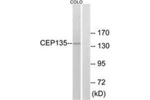 Western blot analysis of extracts from COLO cells, using CEP135 Antibody. (CEP135 Antikörper  (AA 1081-1130))