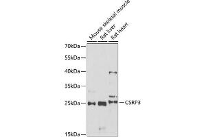 Western blot analysis of extracts of various cell lines, using CSRP3 antibody (ABIN6129258, ABIN6139141, ABIN6139143 and ABIN6222244) at 1:1000 dilution. (CSRP3 Antikörper  (AA 1-194))