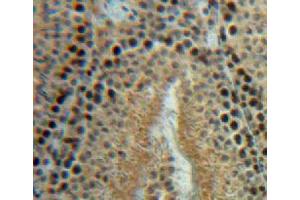 Used in DAB staining on fromalin fixed paraffin-embedded testis tissue (HSPH1 Antikörper  (AA 595-733))