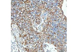 IHC analysis of TACI using anti-TACI antibody (ABIN5692816).